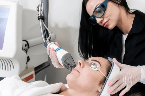 Carbon Laser Treatment in Lucknow